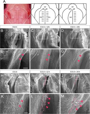 Observation of the Epithelial Cell Behavior in the Nasal Septum During Primary Palate Closure in Mice